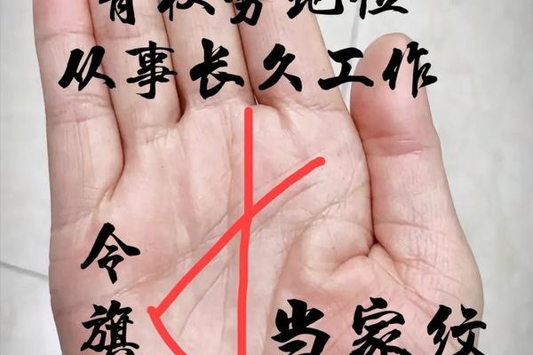 掌中痣挂相-脱痣挂什么科