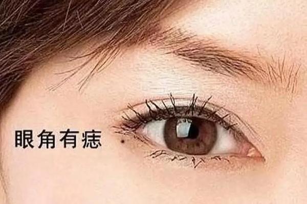 右上眼皮痣相-右眼皮有个痣叫什么痣