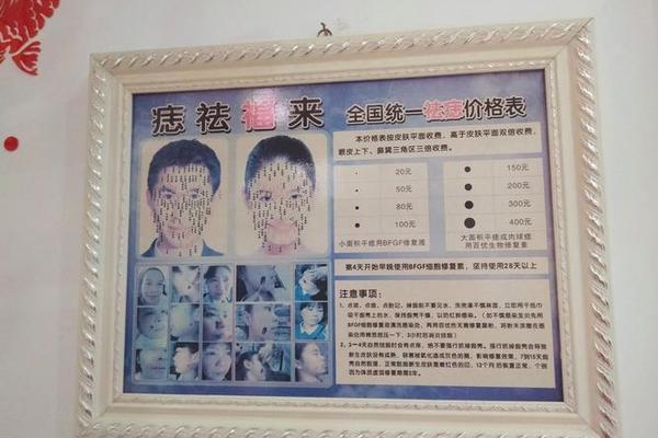 淮北相山祛痣比较好;淮北人民医院点痣多少钱