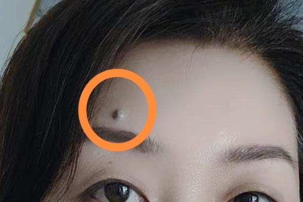 痣相缘红姐(媒婆痣位置) 痣相缘红姐(媒婆痣位置)