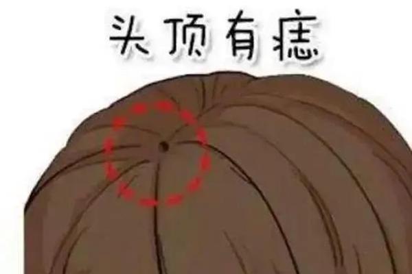 头发里痣相;头发里有痣位置图
