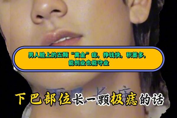 男相下巴有痣—男孩子下巴正中间有个痣