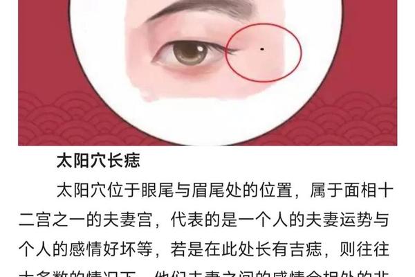 太阳穴上方的痣相;头顶痣的位置与命运图解男人 太阳穴上方的痣相;头顶痣的位置与命运图解男人