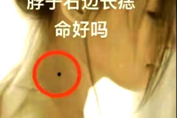 脖子前痣相-脖颈有痣 痣相图解 脖子前痣相-脖颈有痣 痣相图解