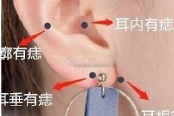 耳朵上有痣的人富相、耳朵上的折富痣是什么意思