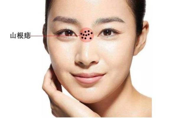 看女人三根有痣相_女生山根有痣