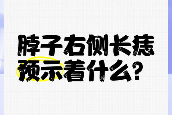 脖子右边的痣相、脖子右侧痣相图解大全 脖子右边的痣相、脖子右侧痣相图解大全