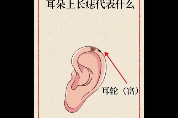 后脑勺长痣是什么相、后脑勺有痣图解