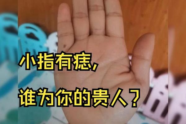 左手小指痣图解痣相_小拇指有痣的女人 左手小指痣图解痣相_小拇指有痣的女人