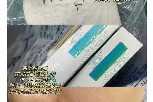 相城医院手术切痣多少钱、医院切痣 手术价格