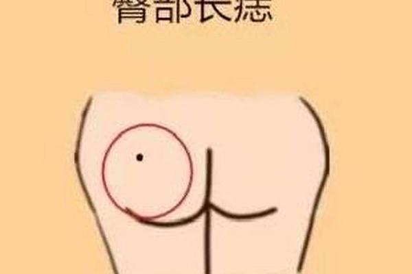 痣相臀尖上有痣的女人,面相痣的图片大全