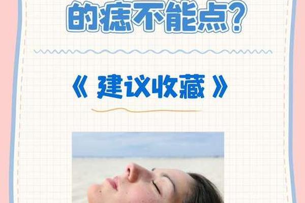 点了痣就是破了相吗、痣破了能点吗 点了痣就是破了相吗、痣破了能点吗