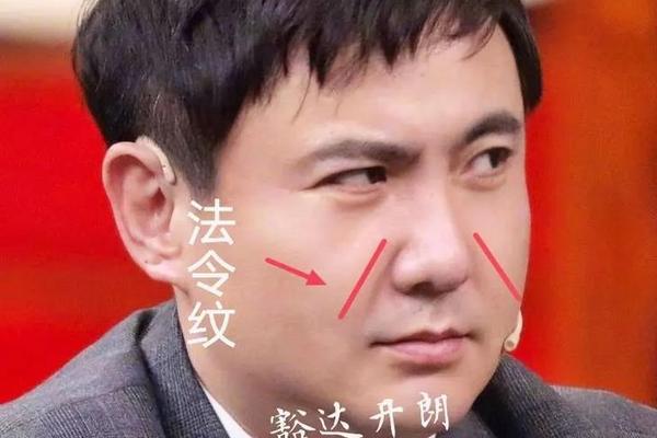 脸上八字纹