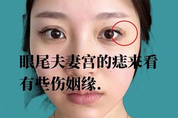 长痣怎么看出夫妻相、夫妻痣长在同一个地方