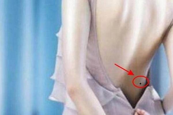 左腰痣相—女人左侧腰部痣相图解