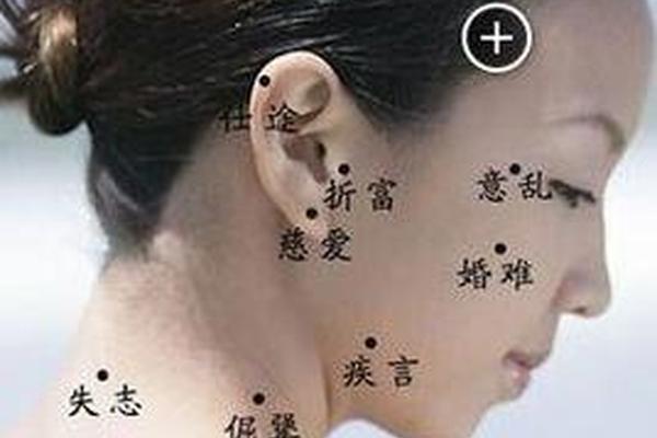 女人脖子下部痣相最准图-痣凸起来要去除吗