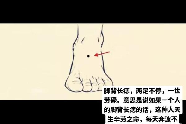 右脚背痣相;右脚背有痣代表什么