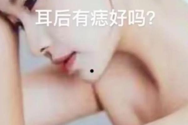 痣相男生耳后有痣(男人耳朵后面有痣图解)