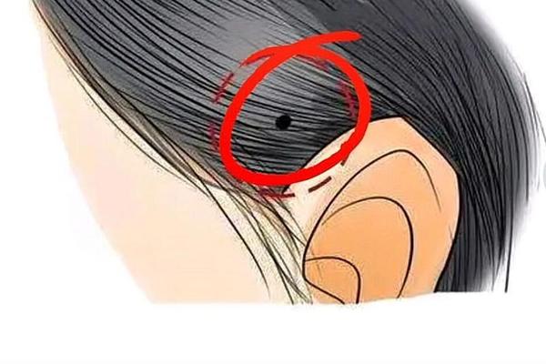 男人头发隐藏的痣相含义、痣相大全图解 男人头发隐藏的痣相含义、痣相大全图解