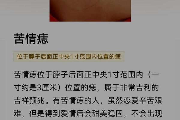 痣相脖子中间视.(脖子前正中间长一颗痣)