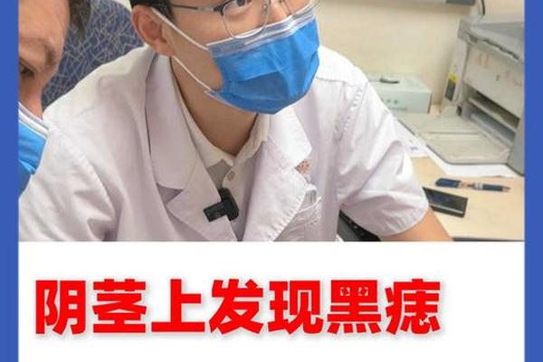 剥皮长痣相_男人生殖上有痣