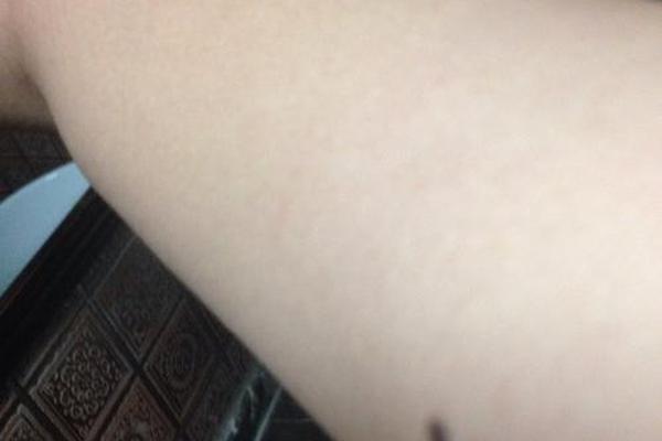 胳膊痣相三角形(左手臂三颗痣三角形) 胳膊痣相三角形(左手臂三颗痣三角形)