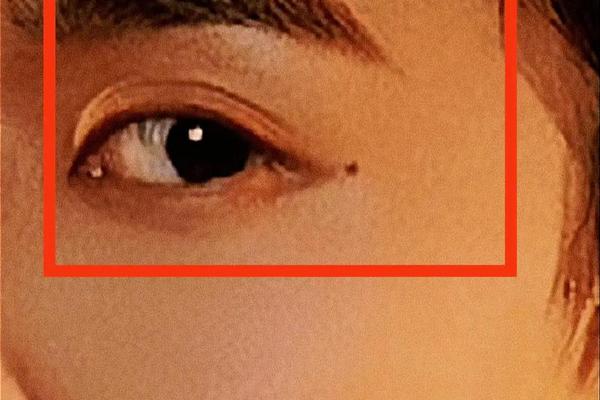 男生女相眼角痣—男生眼角的痣叫什么 男生女相眼角痣—男生眼角的痣叫什么