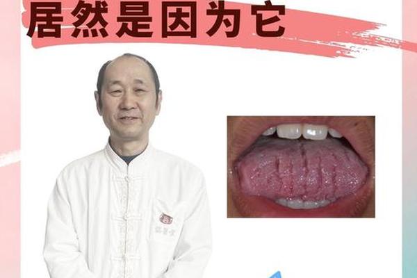 舌尖上有颗痣是什么相 舌头上有痣必大富大贵