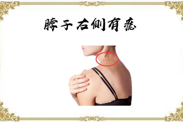 女人颈部痣相最新图解、颈部长痣图解女性 女人颈部痣相最新图解、颈部长痣图解女性