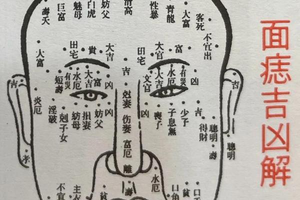 生辰八字和痣相矛盾吗;痣对命运的影响大吗