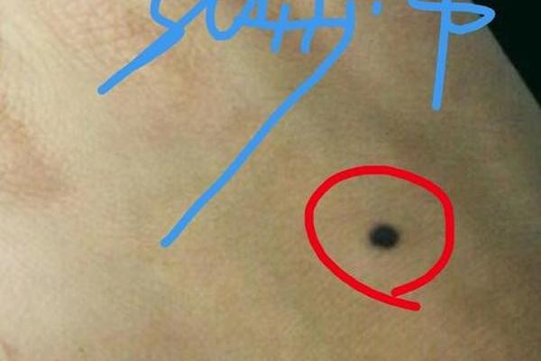 男人怎么相珍珠痣 男人有哪些痣是好的