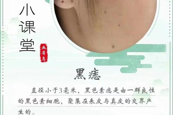 怎样治疗痣相,黑痣的治疗方法
