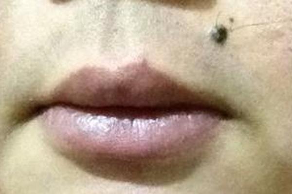 男人嘴皮上嘴唇痣相;嘴皮上长痣的人好吗 男人嘴皮上嘴唇痣相;嘴皮上长痣的人好吗