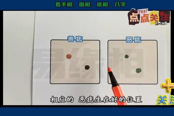 麻衣神相瘊子与痣_瘊子和痣的区别图