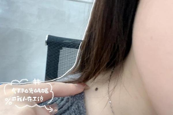 痣相 颈—左颈长痣好不好