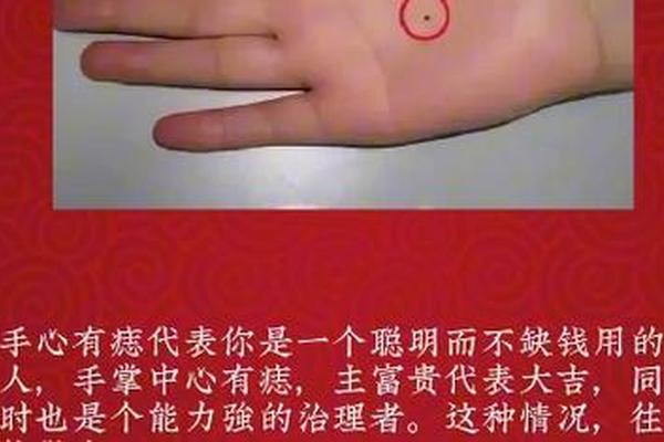 手心长痣富贵相(手心里面长痣代表什么)
