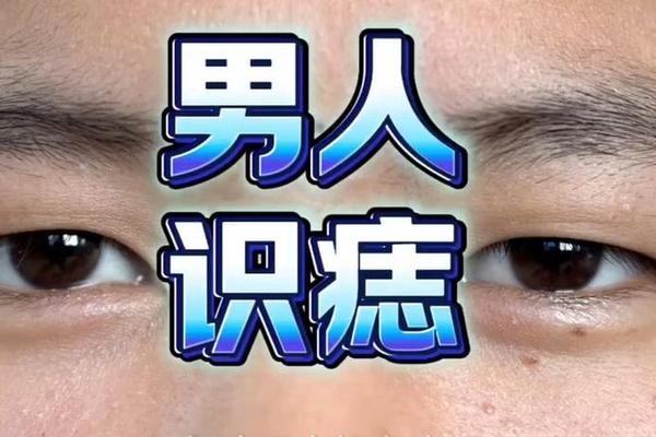 痣相男人下巴志;下巴左边有痣的男人