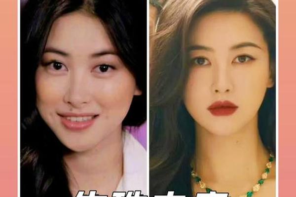 明星脸上的痣相—哪些明星把痣点掉了 明星脸上的痣相—哪些明星把痣点掉了