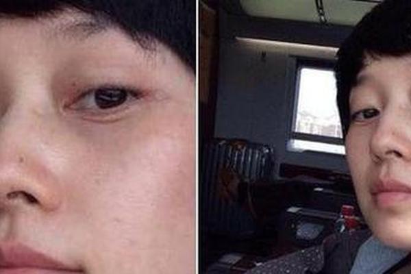 眼相卧蚕有痣,男人眼下卧蚕面相 眼相卧蚕有痣,男人眼下卧蚕面相