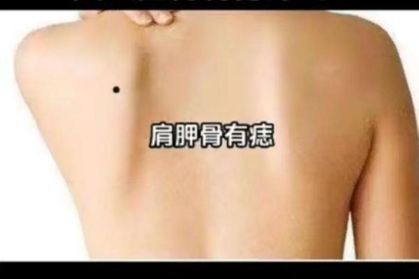 女生面痣相解图、女生后背痣相图解大全