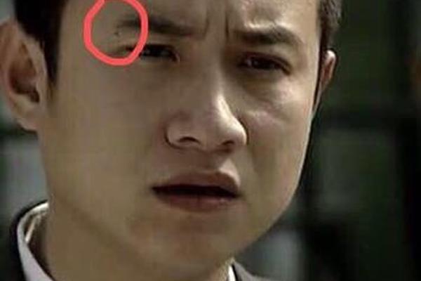 右边脖有棕痣是什么相(棕色痣是善痣还是恶痣) 右边脖有棕痣是什么相(棕色痣是善痣还是恶痣)